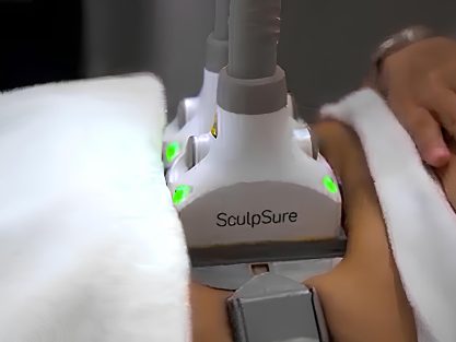 sculpsure-ne-ise-yarar